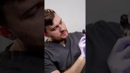 Dental Malocclusion in Dogs | Top 100 common disease in dogs #shorts #bellaandbuddy #malocclusion